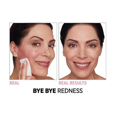Bye Bye Foundation Full Coverage Moisturizer™ with SPF 50+