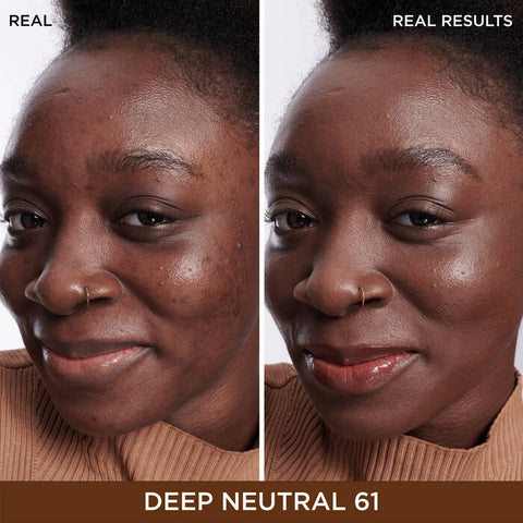 Bye Bye Dark Spots Concealer + Serum