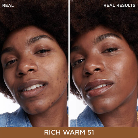 Bye Bye Dark Spots Concealer + Serum